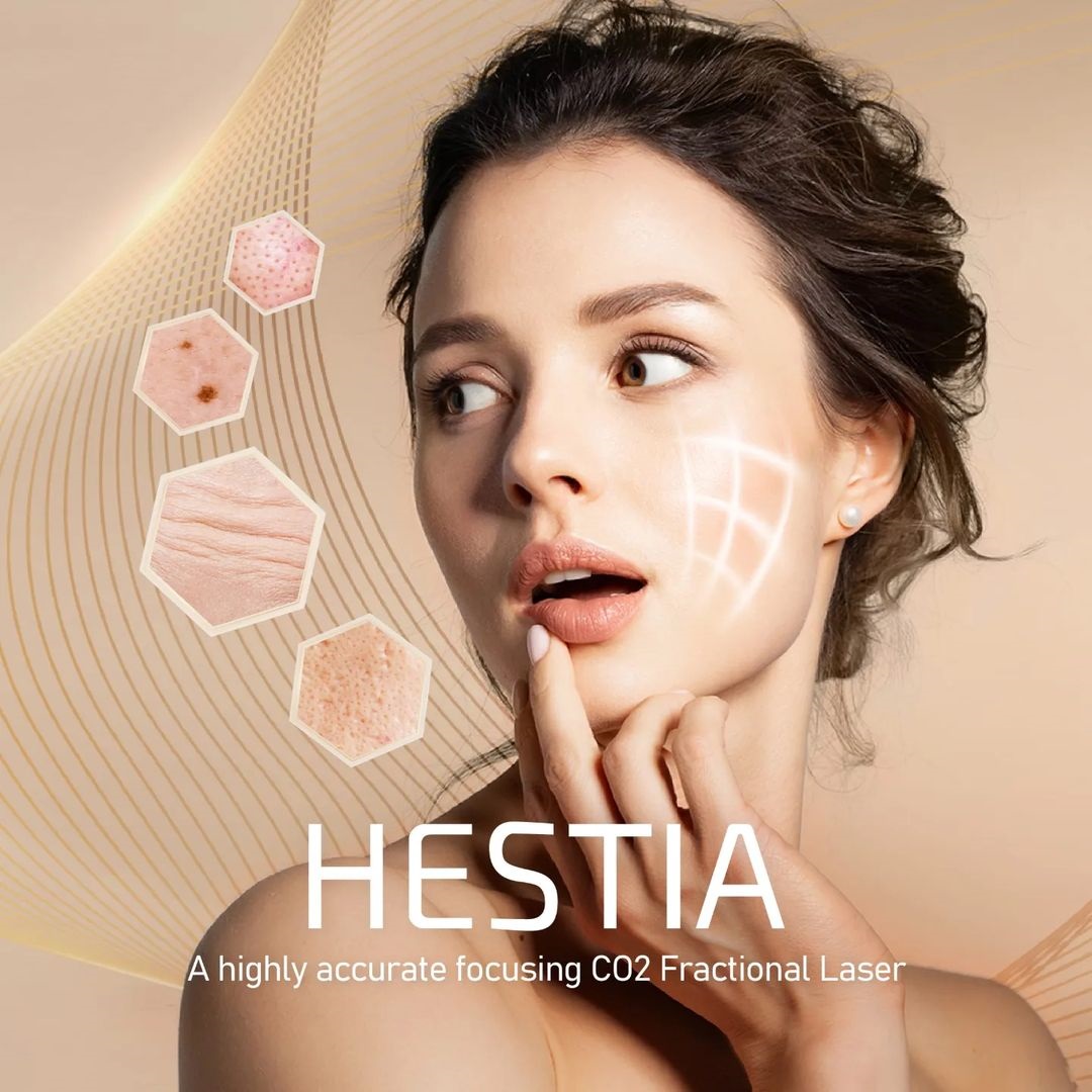 HESTIA POST 2 HESTIA POST 2