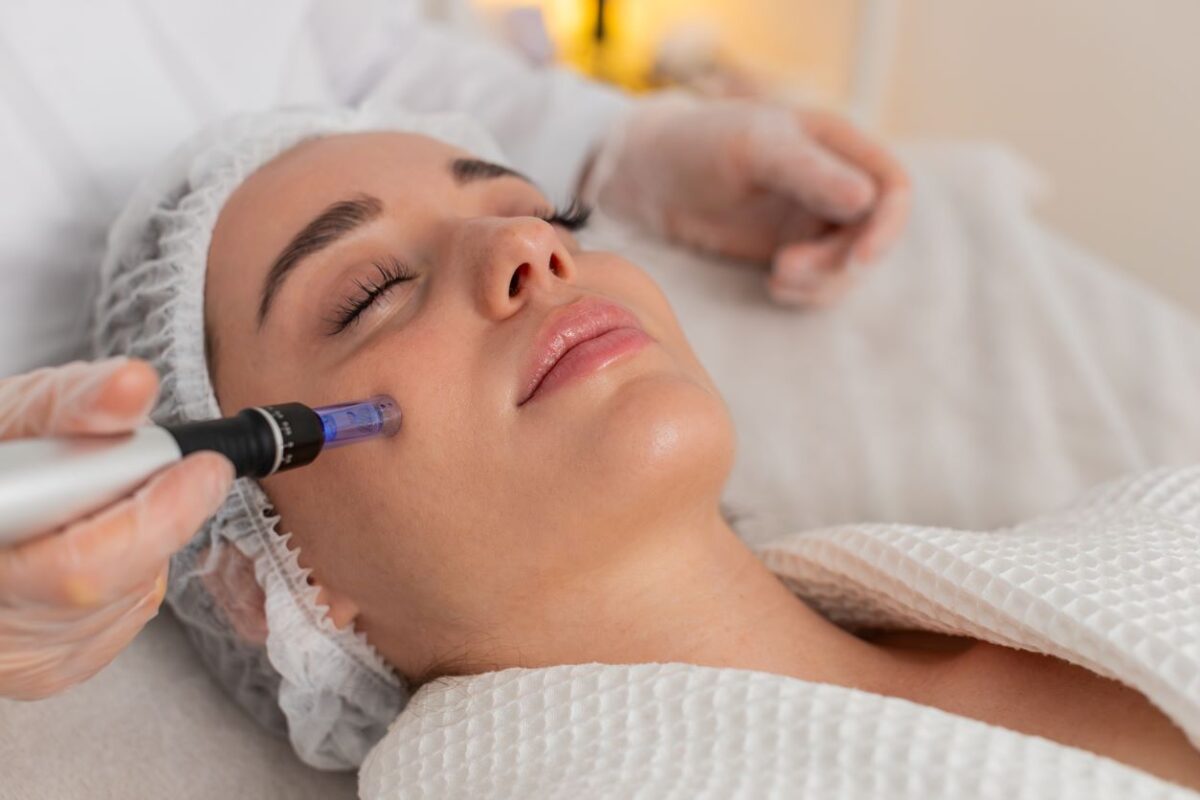 microneedling-i-stochevmeni-epanekkinisi-tis-epidermidas-1200x800.jpg